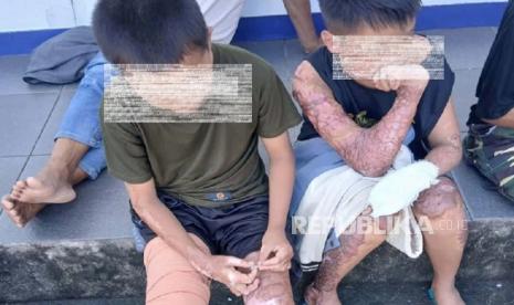 DPR Minta Siapa Pun yang Terlibat dalam Kasus Pembakaran 3 Santri di Lombok Ditindak Tegas